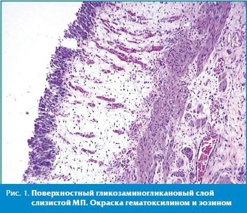 Поверхностный гликозаминогликановый слой слизистой МП.