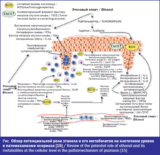 Обзор потенциальной роли этанола и его метаболитов на клеточном уровне в патомеханизме псориаза