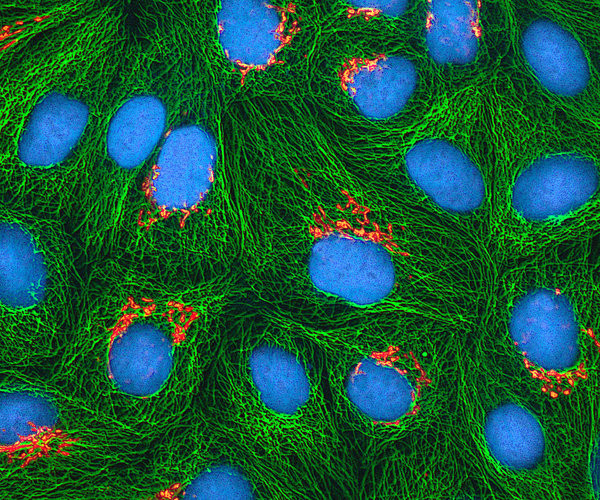 HeLa, клетки, клеточная культура