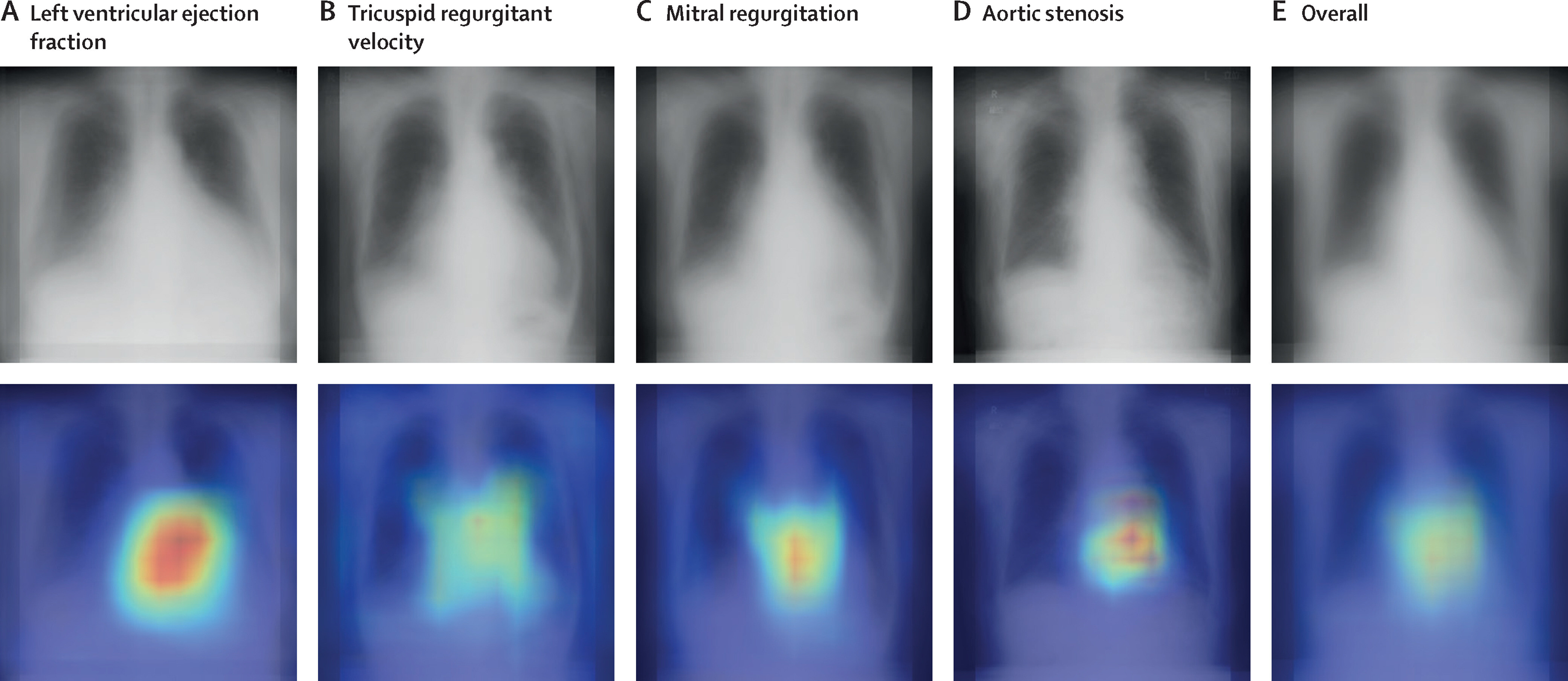 Оценка базовых показателей функций сердца по данным рентгенограмм