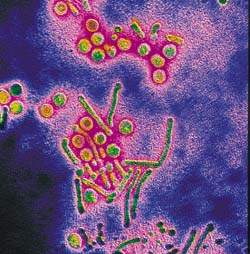 Цитомегаловирус как причина атеросклероза